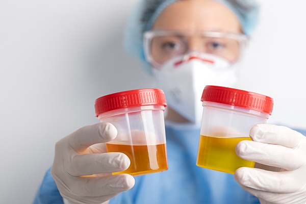 Infecciones Urinarias Recurrentes